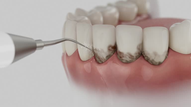 Reliable Dental contractor in Normandy Park, WA by Dentist Open Now